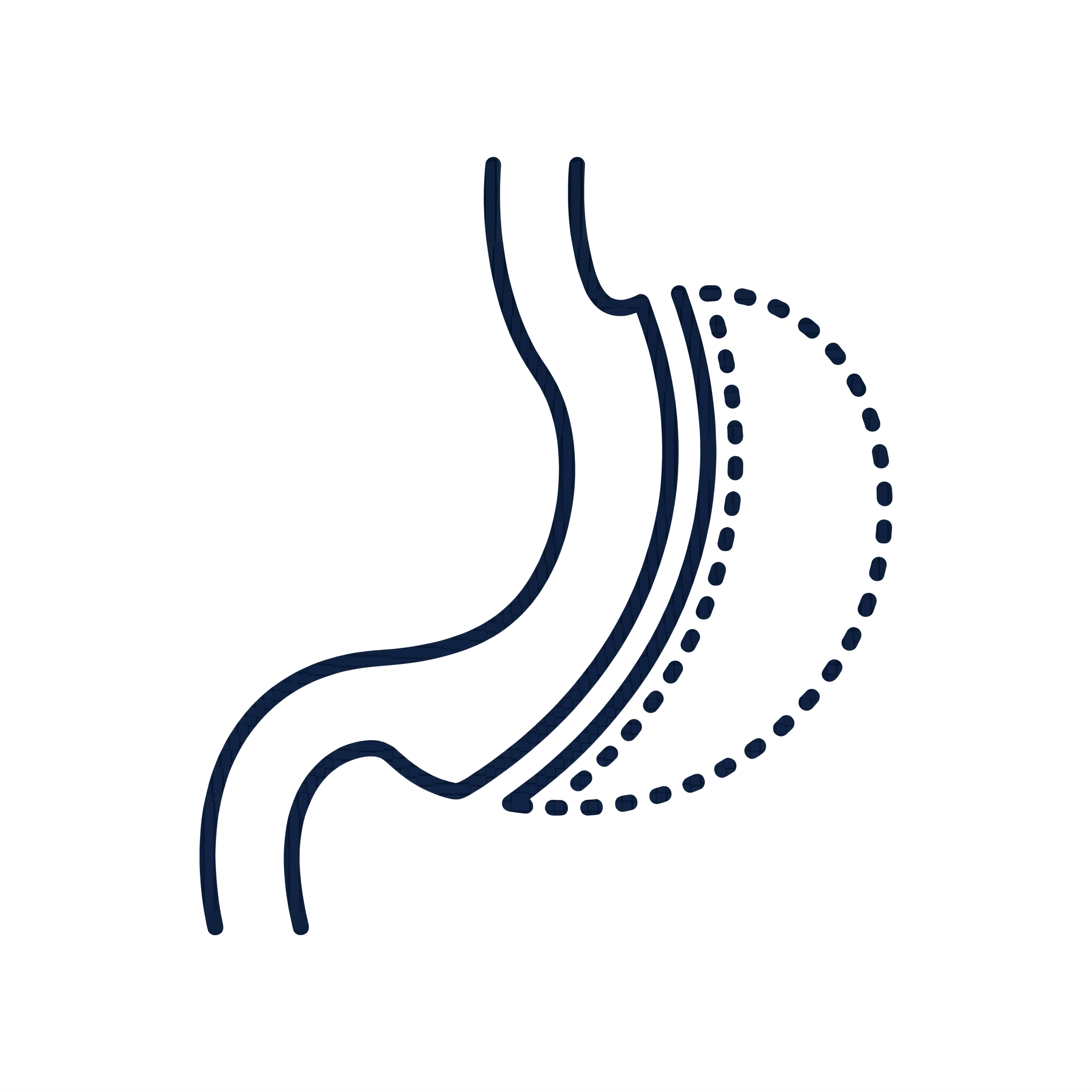 Gastric sleeve icoon